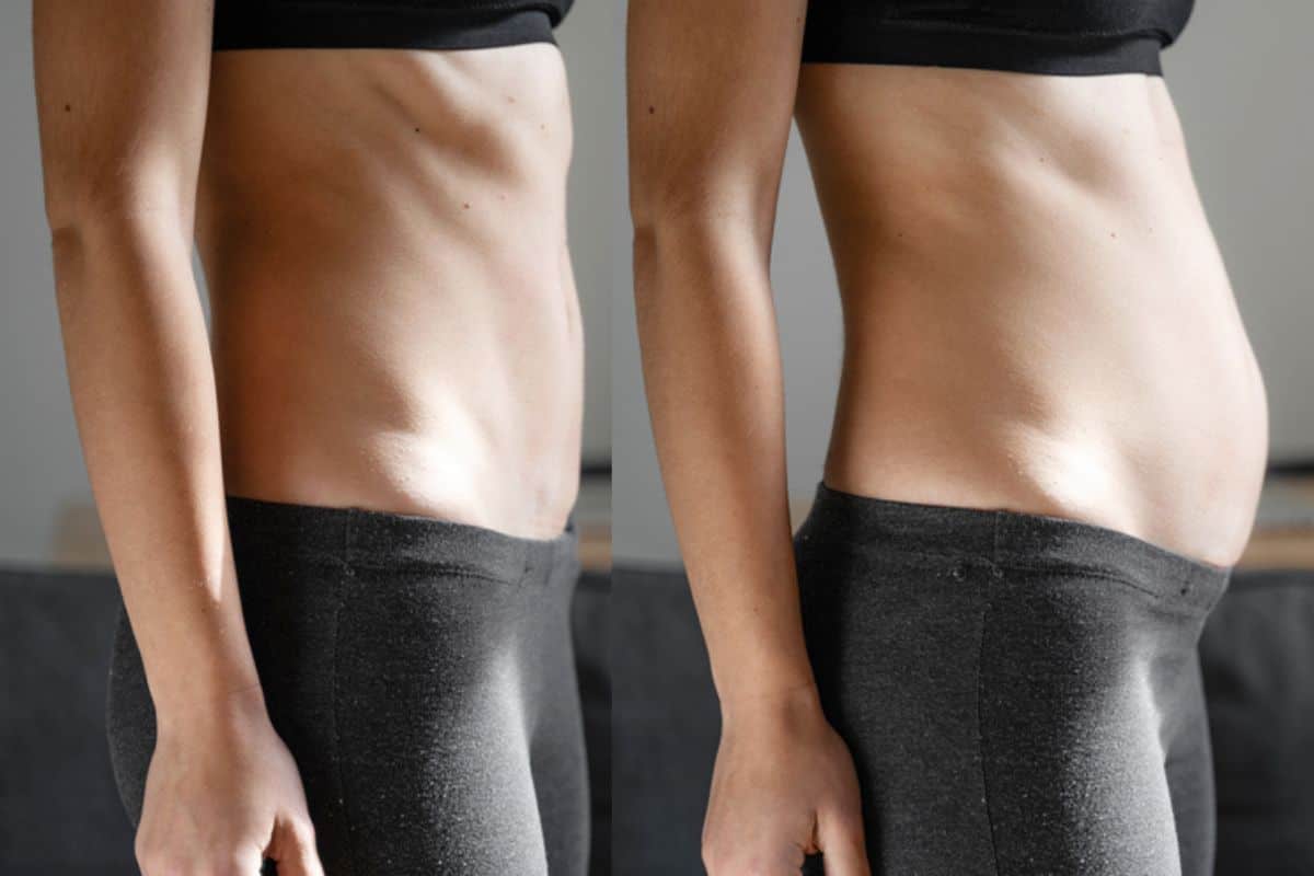 How long does diastasis recti take to improve Lewisham?