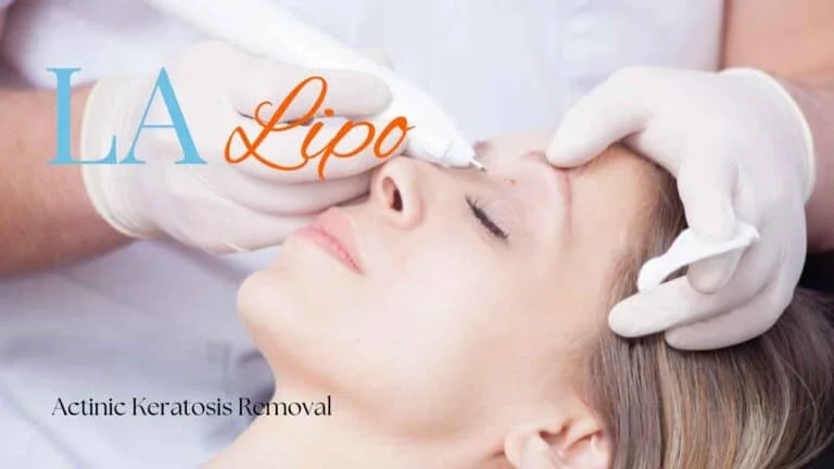 Woman receiving Actinic Keratosis Removal Treatment Lewisham