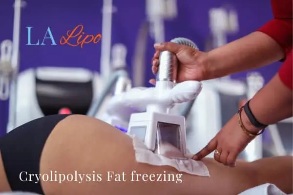 women getting fat freezing Lewisham