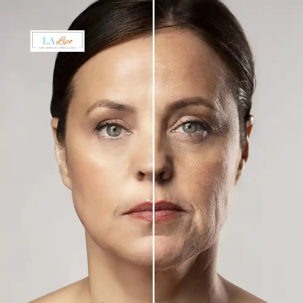 How Can You Tell If Non-Surgical Skin Tightening Is Right for You Lewisham?