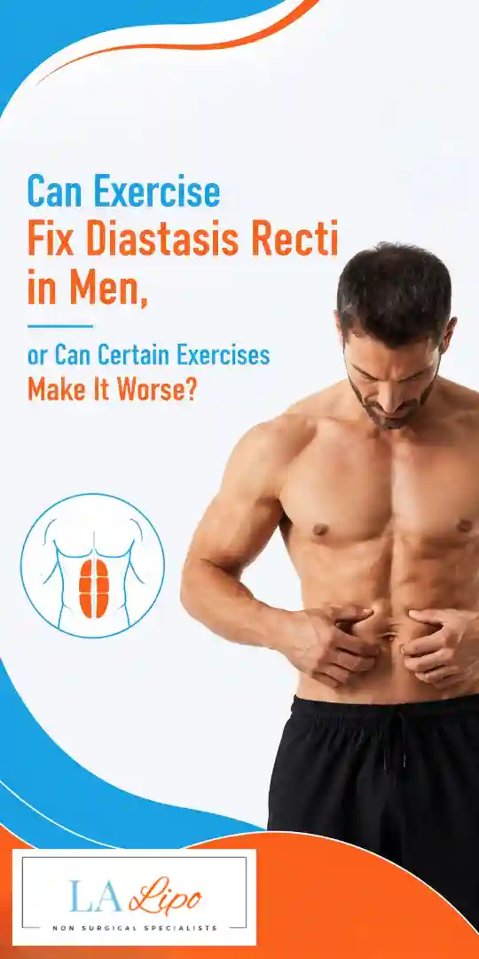 Can Exercise Fix Diastasis Recti in Men, or Can Certain Exercises Make It Worse Lewisham?